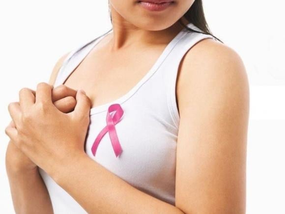 Ung thư biểu mô ống dẫn sữa tại chỗ (DCIS) là giai đoạn rất sớm của ung thư vú, khi các tế bào ung thư chỉ nằm trong các ống dẫn sữa và chưa xâm nhập qua màng đáy. 