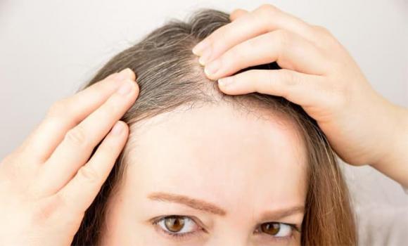 Thiếu dinh dưỡng:Nhiều người trẻ bị tóc bạc do cơ thể thiếu hụt protein và các vi chất thiết yếu. 