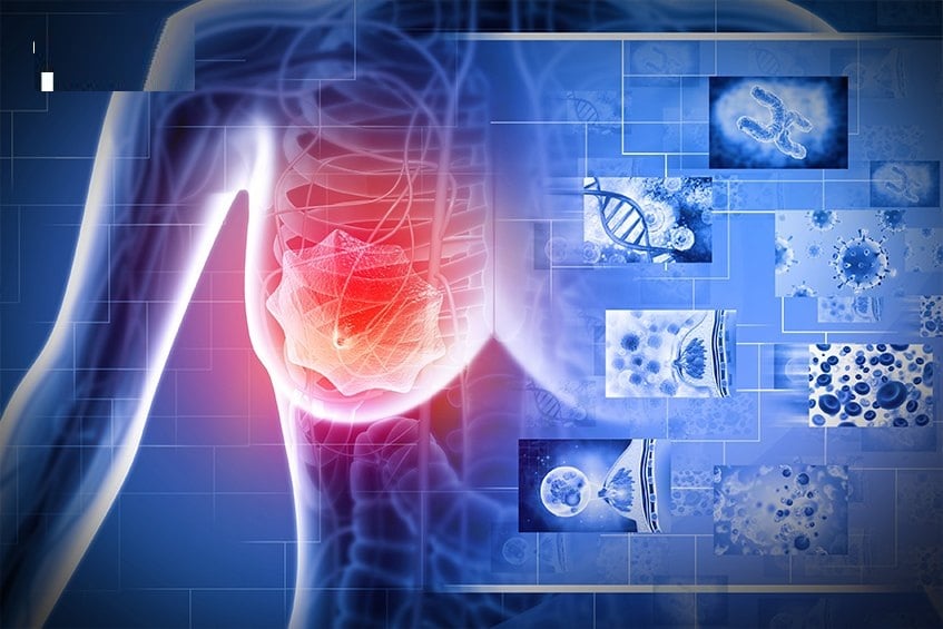 Thông thường, nốt ruồi lành tính sẽ có màu nâu ổn định, kích thước và hình dạng không đổi theo thời gian.