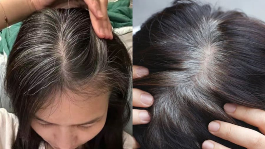 Thức khuya, hút thuốc là những yếu tố có thể đẩy nhanh tốc độ lão hóa của tóc, làm tóc bạc sớm.